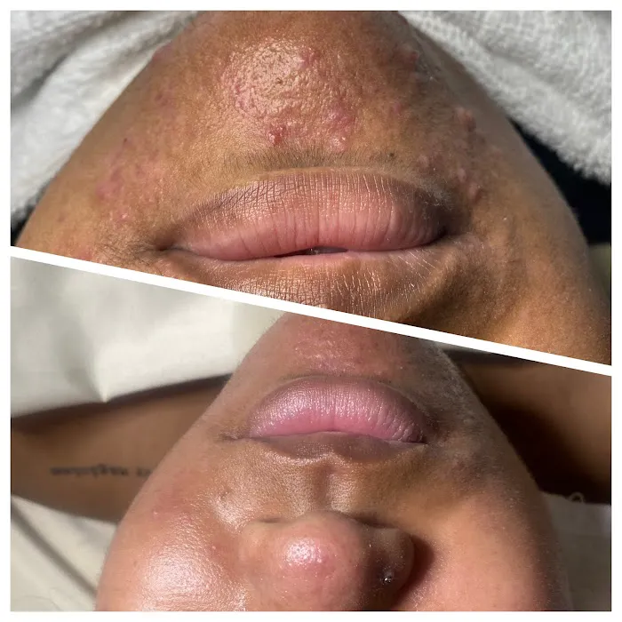 True Skin by Blair Picture 3