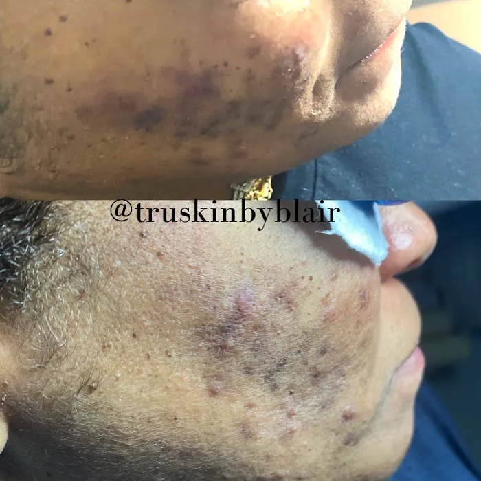 True Skin by Blair Picture 6