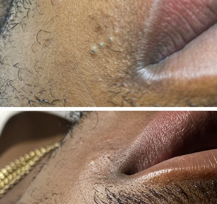 True Skin by Blair Picture 7