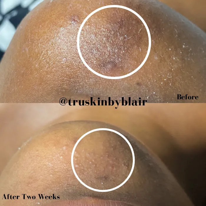 True Skin by Blair Picture 10