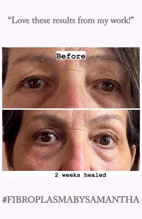 Fibroplasma by Samantha Beverly Hills Picture 1