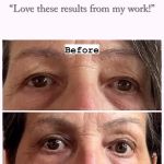 Fibroplasma by Samantha Beverly Hills