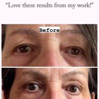 Fibroplasma by Samantha Beverly Hills ico