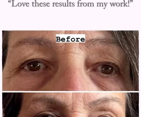 Fibroplasma by Samantha Beverly Hills