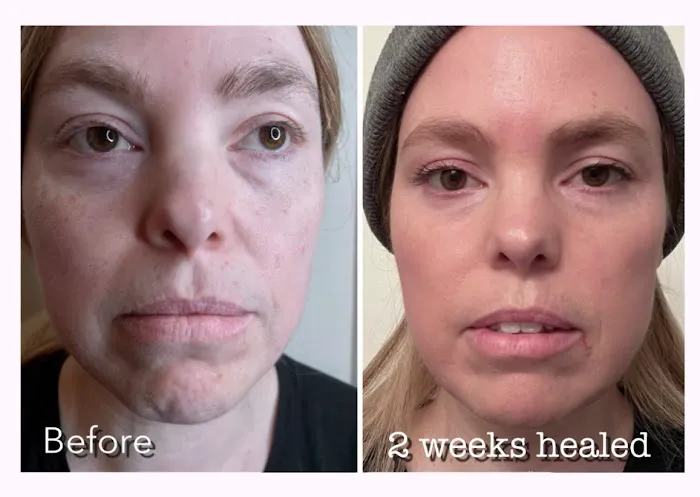 Fibroplasma by Samantha Beverly Hills Picture 3