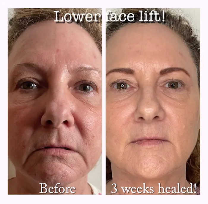 Fibroplasma by Samantha Beverly Hills Picture 2