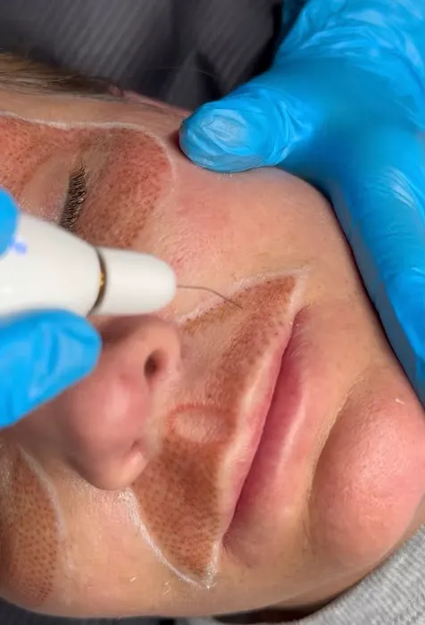 Fibroplasma by Samantha Beverly Hills Picture 6