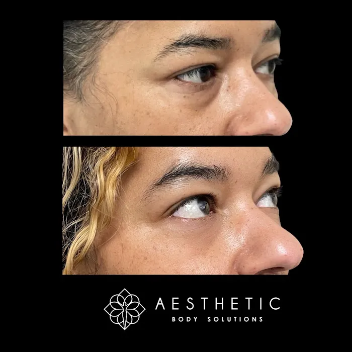 Aesthetic Body Solutions Picture 9