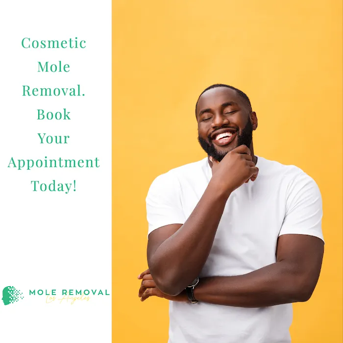 Mole Removal Los Angeles Picture 5