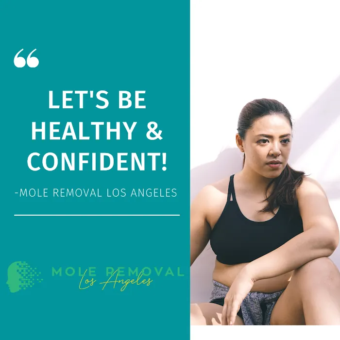 Mole Removal Los Angeles Picture 7