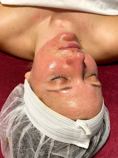 Skin Sanctuary | Acne + Skin Healing Specialist | DMK Enzyme Therapy Picture 5