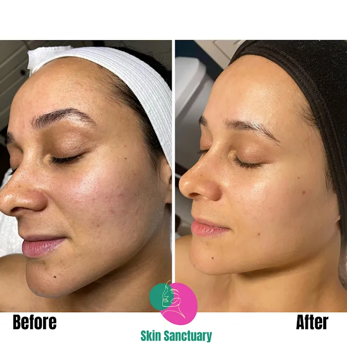 Skin Sanctuary | Acne + Skin Healing Specialist | DMK Enzyme Therapy Picture 7