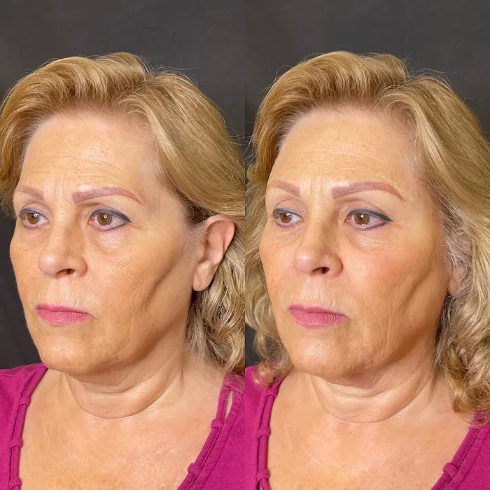 theartofinjections Picture 2