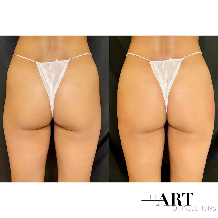 theartofinjections Picture 5