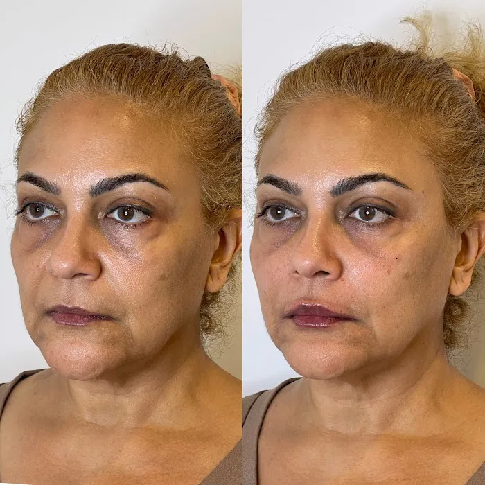 theartofinjections Picture 3