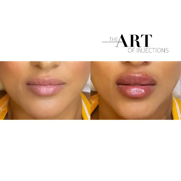 theartofinjections Picture 4