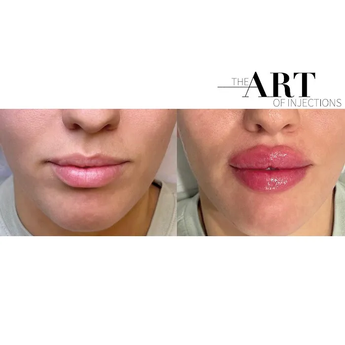 theartofinjections Picture 6