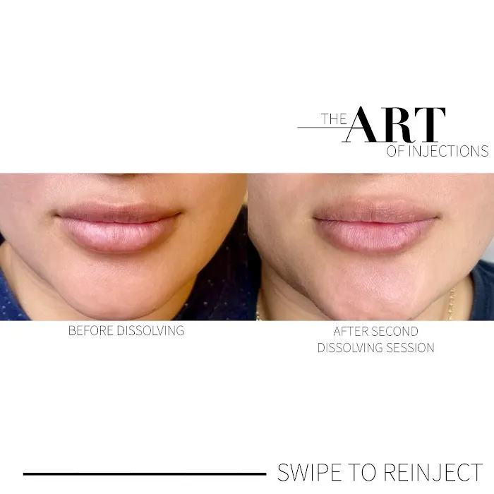 theartofinjections Picture 7