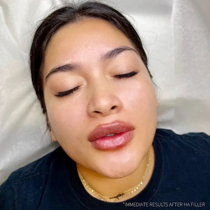 theartofinjections Picture 9