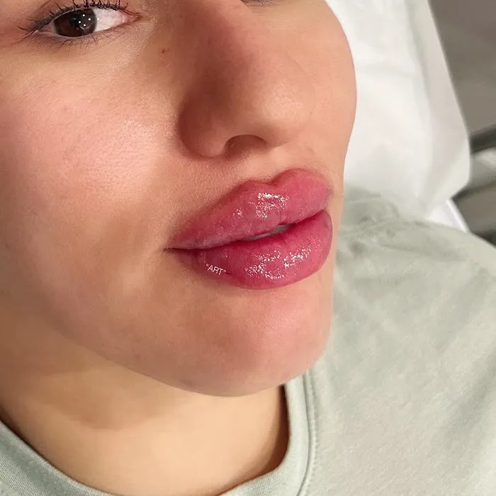 theartofinjections Picture 10