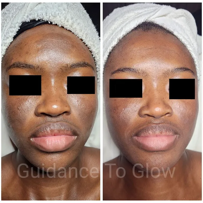 Guidance to Glow Skin Care Picture 5