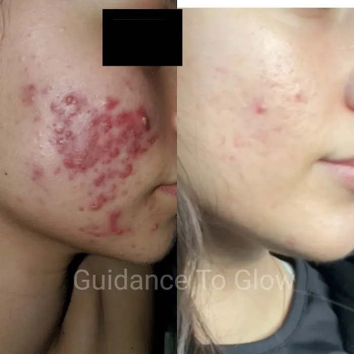 Guidance to Glow Skin Care Picture 8