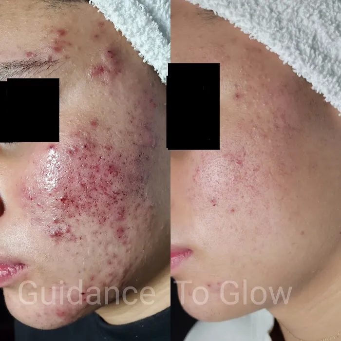 Guidance to Glow Skin Care Picture 6