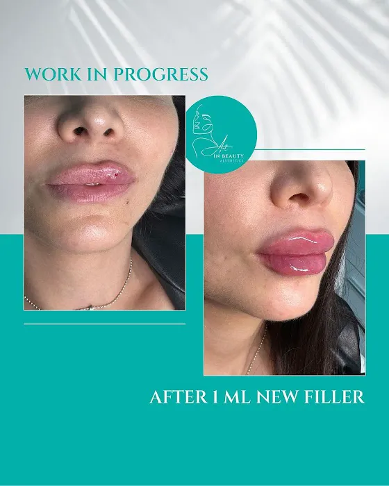 Art In Beauty Aesthetics Picture 5