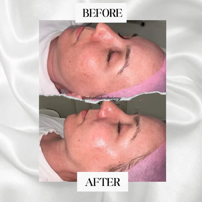 Athena Skin Therapy Picture 2