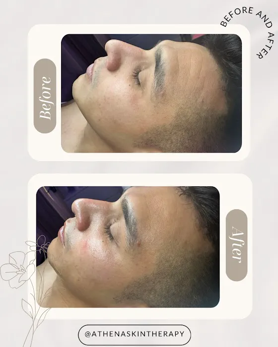 Athena Skin Therapy Picture 3