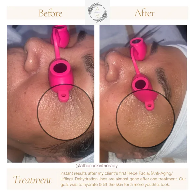 Athena Skin Therapy Picture 4