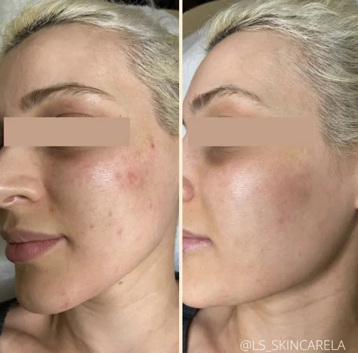 L'S SKINCARE LA Picture 5