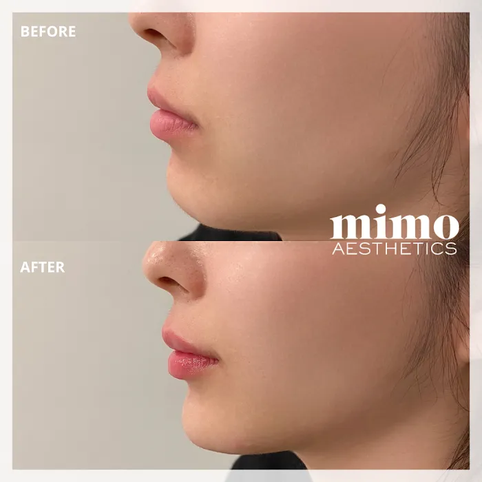 mimo aesthetics Picture 6