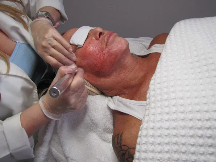 DePiano Skin - West Hollywood Skin Care Picture 4