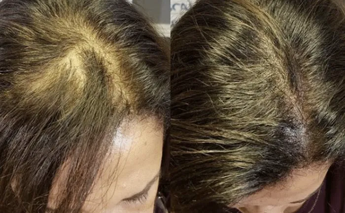 OC Esthetique and Spa Picture 7