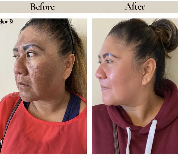 Dijan Skin Care Picture 7