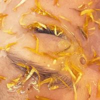 Supportive Skin Therapy ico