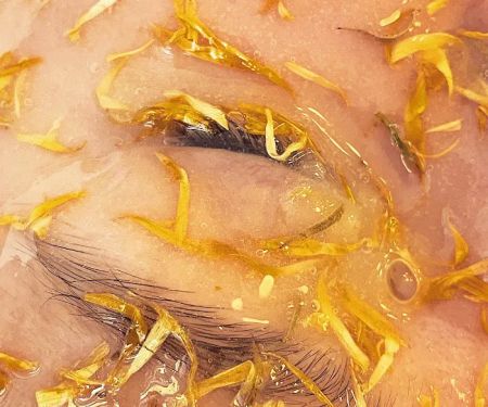 Supportive Skin Therapy