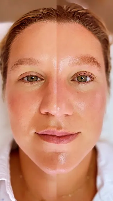 Supportive Skin Therapy Picture 8