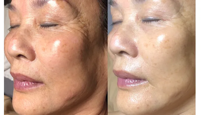 Aura Skin Care Picture 1