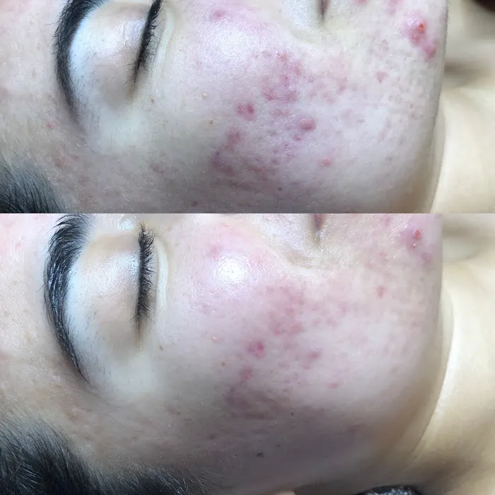 Aura Skin Care Picture 4