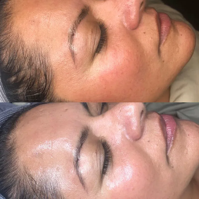 Aura Skin Care Picture 5