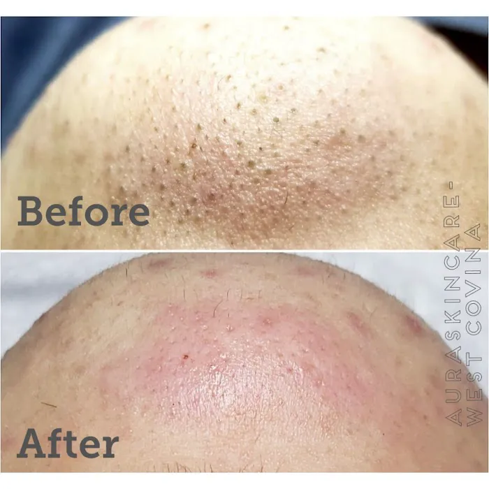 Aura Skin Care Picture 7