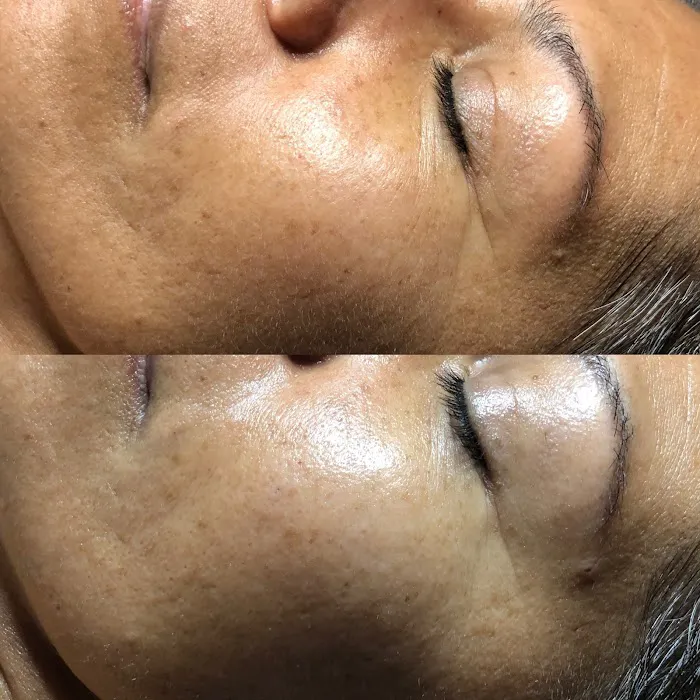 Aura Skin Care Picture 9