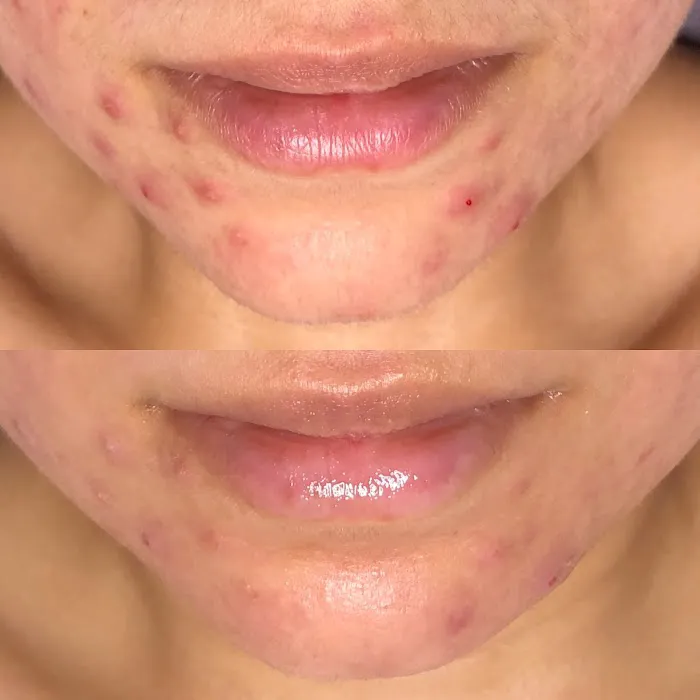 Aura Skin Care Picture 10