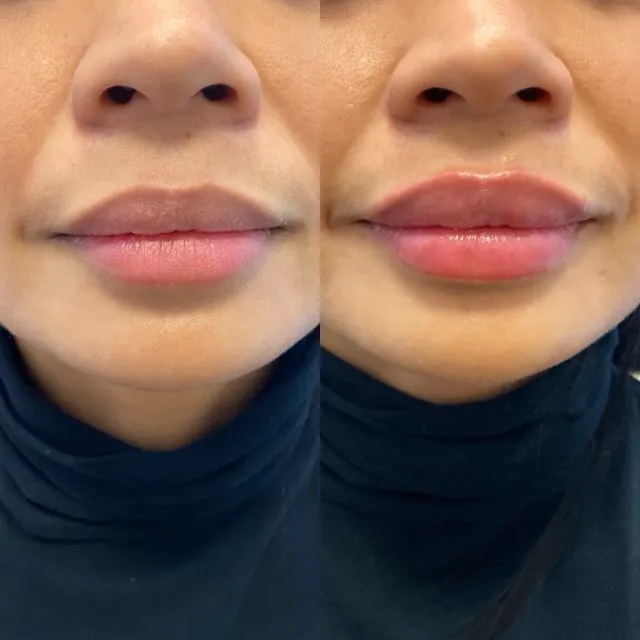 Ajliss Medical Aesthetics Picture 1