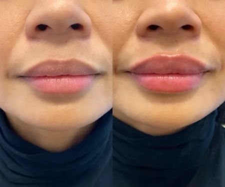 Ajliss Medical Aesthetics