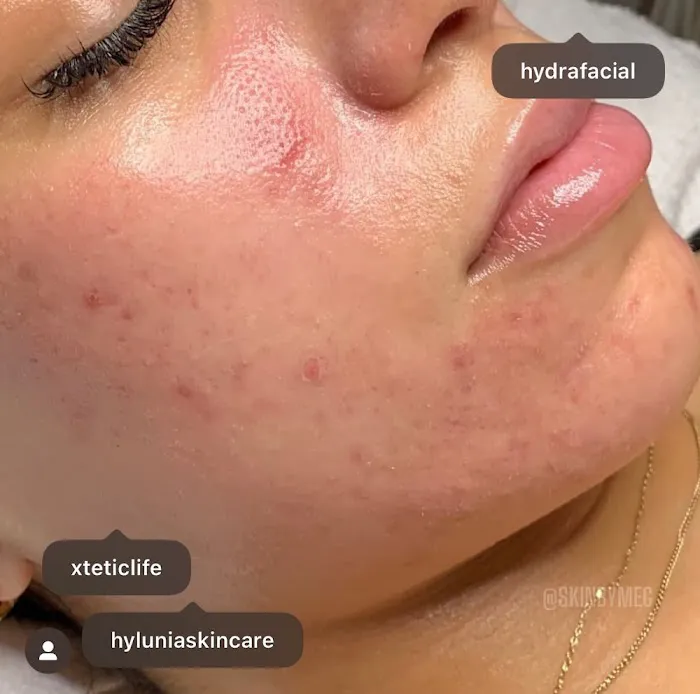 Skin by Meg Picture 9