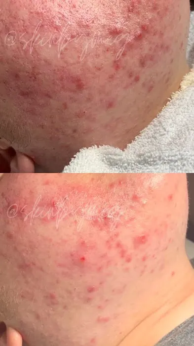 Skin by Meg Picture 7