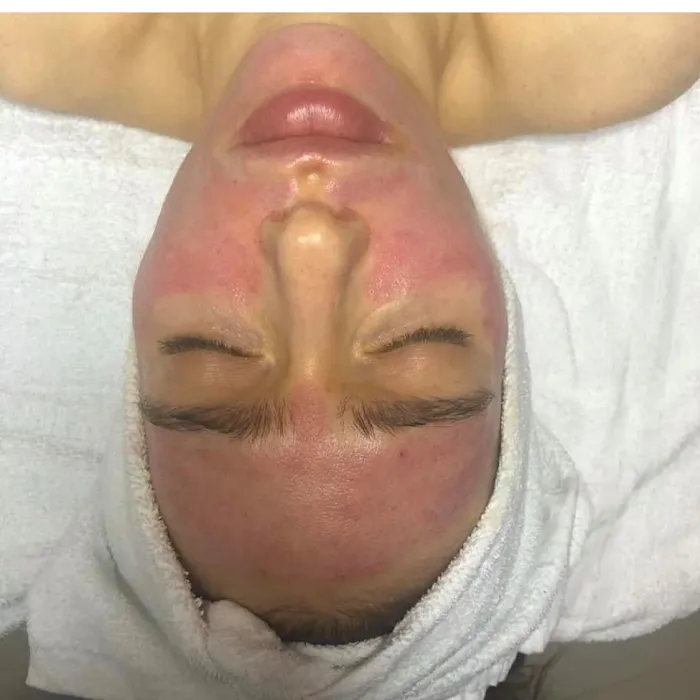 Ritual Skincare Therapy Picture 8